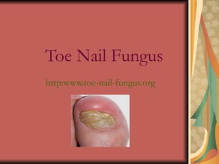 Toe Nail Fungus http:www.toe-nail-fungus.org 