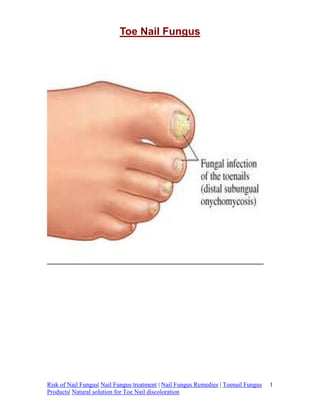 Toe Nail Fungus




Risk of Nail Fungus| Nail Fungus treatment | Nail Fungus Remedies | Toenail Fungus   1
Products| Natural solution for Toe Nail discoloration
 