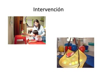 Intervención
 