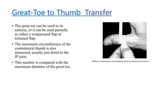 Great-Toe to Thumb Transfer
• The great toe can be used in its
entirety, or it can be used partially
as either a wraparound flap or
trimmed flap.
• The maximum circumference of the
contralateral thumb is also
measured, usually just distal to the
IP joint.
• This number is compared with the
maximum diameter of the great toe.
 