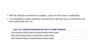 • With the skeletal reconstruction complete, repair of soft tissues is undertaken.
• It is preferable to repair tendinous structures first, then the nerves, followed by the
artery and finally the vein.
 