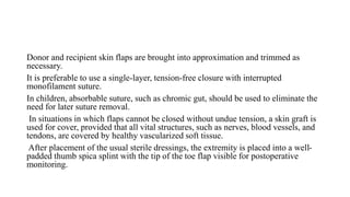 Donor and recipient skin flaps are brought into approximation and trimmed as
necessary.
It is preferable to use a single-layer, tension-free closure with interrupted
monofilament suture.
In children, absorbable suture, such as chromic gut, should be used to eliminate the
need for later suture removal.
In situations in which flaps cannot be closed without undue tension, a skin graft is
used for cover, provided that all vital structures, such as nerves, blood vessels, and
tendons, are covered by healthy vascularized soft tissue.
After placement of the usual sterile dressings, the extremity is placed into a well-
padded thumb spica splint with the tip of the toe flap visible for postoperative
monitoring.
 