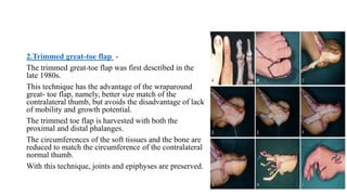 2.Trimmed great-toe flap -
The trimmed great-toe flap was first described in the
late 1980s.
This technique has the advantage of the wraparound
great- toe flap, namely, better size match of the
contralateral thumb, but avoids the disadvantage of lack
of mobility and growth potential.
The trimmed toe flap is harvested with both the
proximal and distal phalanges.
The circumferences of the soft tissues and the bone are
reduced to match the circumference of the contralateral
normal thumb.
With this technique, joints and epiphyses are preserved.
 