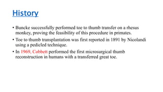 History
• Buncke successfully performed toe to thumb transfer on a rhesus
monkey, proving the feasibility of this procedure in primates.
• Toe to thumb transplantation was first reported in 1891 by Nicolandi
using a pedicled technique.
• In 1969, Cobbett performed the first microsurgical thumb
reconstruction in humans with a transferred great toe.
 