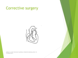 Corrective surgery
JERIN.T.S, 3RD YEAR BSC NURSING, KRSMCON MANGALORE. PH:
+919496743672
 