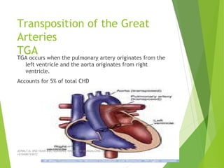 Transposition of the Great
Arteries
TGATGA occurs when the pulmonary artery originates from the
left ventricle and the aorta originates from right
ventricle.
Accounts for 5% of total CHD
JERIN.T.S, 3RD YEAR BSC NURSING, KRSMCON MANGALORE. PH:
+919496743672
 