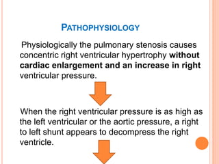 PATHOPHYSIOLOGY
Physiologically the pulmonary stenosis causes
concentric right ventricular hypertrophy without
cardiac enlargement and an increase in right
ventricular pressure.
When the right ventricular pressure is as high as
the left ventricular or the aortic pressure, a right
to left shunt appears to decompress the right
ventricle.
 