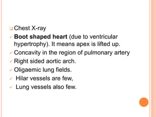  Chest X-ray
 Boot shaped heart (due to ventricular
hypertrophy). It means apex is lifted up.
 Concavity in the region of pulmonary artery
 Right sided aortic arch.
 Oligaemic lung fields.
 Hilar vessels are few,
 Lung vessels also few.
 