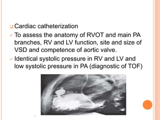 Tetralogy of Fallot (TOF) | PPTX