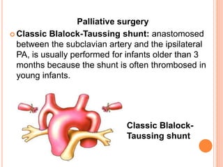 Palliative surgery
 Classic Blalock-Taussing shunt: anastomosed
between the subclavian artery and the ipsilateral
PA, is usually performed for infants older than 3
months because the shunt is often thrombosed in
young infants.
Classic Blalock-
Taussing shunt
 