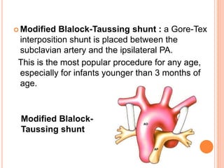  Modified Blalock-Taussing shunt : a Gore-Tex
interposition shunt is placed between the
subclavian artery and the ipsilateral PA.
This is the most popular procedure for any age,
especially for infants younger than 3 months of
age.
Modified Blalock-
Taussing shunt
 