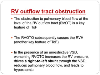 RV outflow tract obstruction
 The obstruction to pulmonary blood flow at the
level of the RV outflow tract (RVOT) is a key
feature of ToF
 The RVOTO subsequently causes the RVH
(another key feature of ToF)
 In the presence of an unrestrictive VSD,
worsening RVOTO increases the RV pressure,
drives a right-to-left shunt through the VSD,
reduces pulmonary blood flow, and leads to
hypoxaemia
 