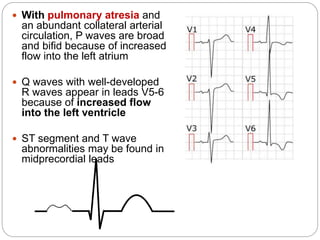  With pulmonary atresia and
an abundant collateral arterial
circulation, P waves are broad
and bifid because of increased
flow into the left atrium
 Q waves with well-developed
R waves appear in leads V5-6
because of increased flow
into the left ventricle
 ST segment and T wave
abnormalities may be found in
midprecordial leads
 