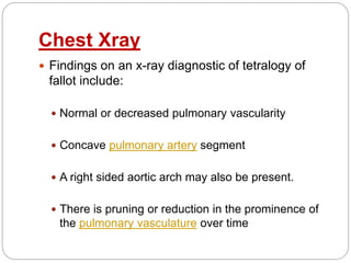 Chest Xray
 Findings on an x-ray diagnostic of tetralogy of
fallot include:
 Normal or decreased pulmonary vascularity
 Concave pulmonary artery segment
 A right sided aortic arch may also be present.
 There is pruning or reduction in the prominence of
the pulmonary vasculature over time
 