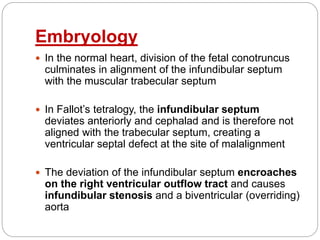 Embryology
 In the normal heart, division of the fetal conotruncus
culminates in alignment of the infundibular septum
with the muscular trabecular septum
 In Fallot’s tetralogy, the infundibular septum
deviates anteriorly and cephalad and is therefore not
aligned with the trabecular septum, creating a
ventricular septal defect at the site of malalignment
 The deviation of the infundibular septum encroaches
on the right ventricular outflow tract and causes
infundibular stenosis and a biventricular (overriding)
aorta
 