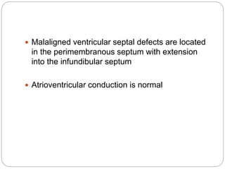  Malaligned ventricular septal defects are located
in the perimembranous septum with extension
into the infundibular septum
 Atrioventricular conduction is normal
 
