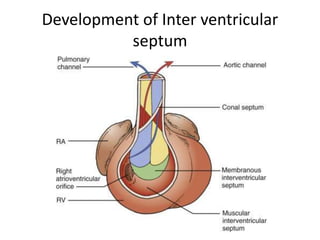Development of Inter ventricular
septum
 
