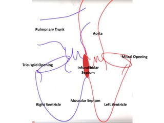 Mitral Opening
Tricuspid Opening
Pulmonary Trunk
Aorta
Right Ventricle Left Ventricle
Muscular Septum
Infundibular
Septum
 