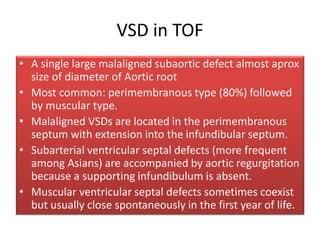 VSD in TOF
• A single large malaligned subaortic defect almost aprox
size of diameter of Aortic root
• Most common: perimembranous type (80%) followed
by muscular type.
• Malaligned VSDs are located in the perimembranous
septum with extension into the infundibular septum.
• Subarterial ventricular septal defects (more frequent
among Asians) are accompanied by aortic regurgitation
because a supporting infundibulum is absent.
• Muscular ventricular septal defects sometimes coexist
but usually close spontaneously in the first year of life.
 