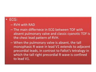 • ECG:
– RVH with RAD
– The main differnece in ECG between TOF with
absent pulmonary valve and classic cyanotic TOF is
the chest lead pattern of RVH.
– When the pulmonary valve is absent, the tall
monophasic R wave in lead V1 extends to adjacent
precordial leads, in contrast to Fallot’s tetralogy in
which the tall right precordial R wave is confined
to lead V1.
 