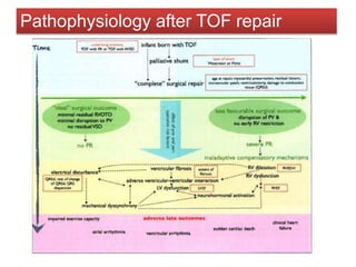 Pathophysiology after TOF repair
 