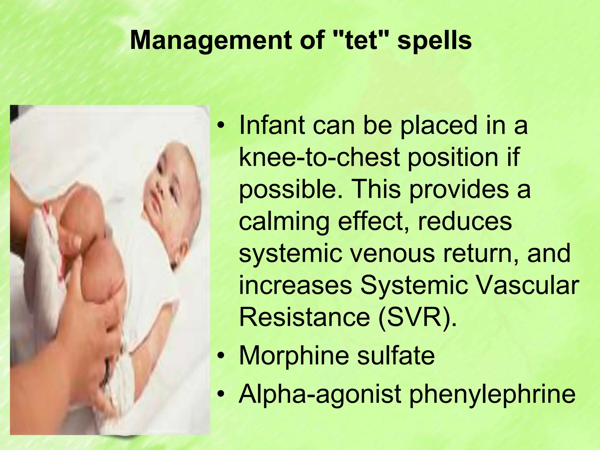 Management of "tet" spells
• Infant can be placed in a
knee-to-chest position if
possible. This provides a
calming effect, reduces
systemic venous return, and
increases Systemic Vascular
Resistance (SVR).
• Morphine sulfate
• Alpha-agonist phenylephrine
 