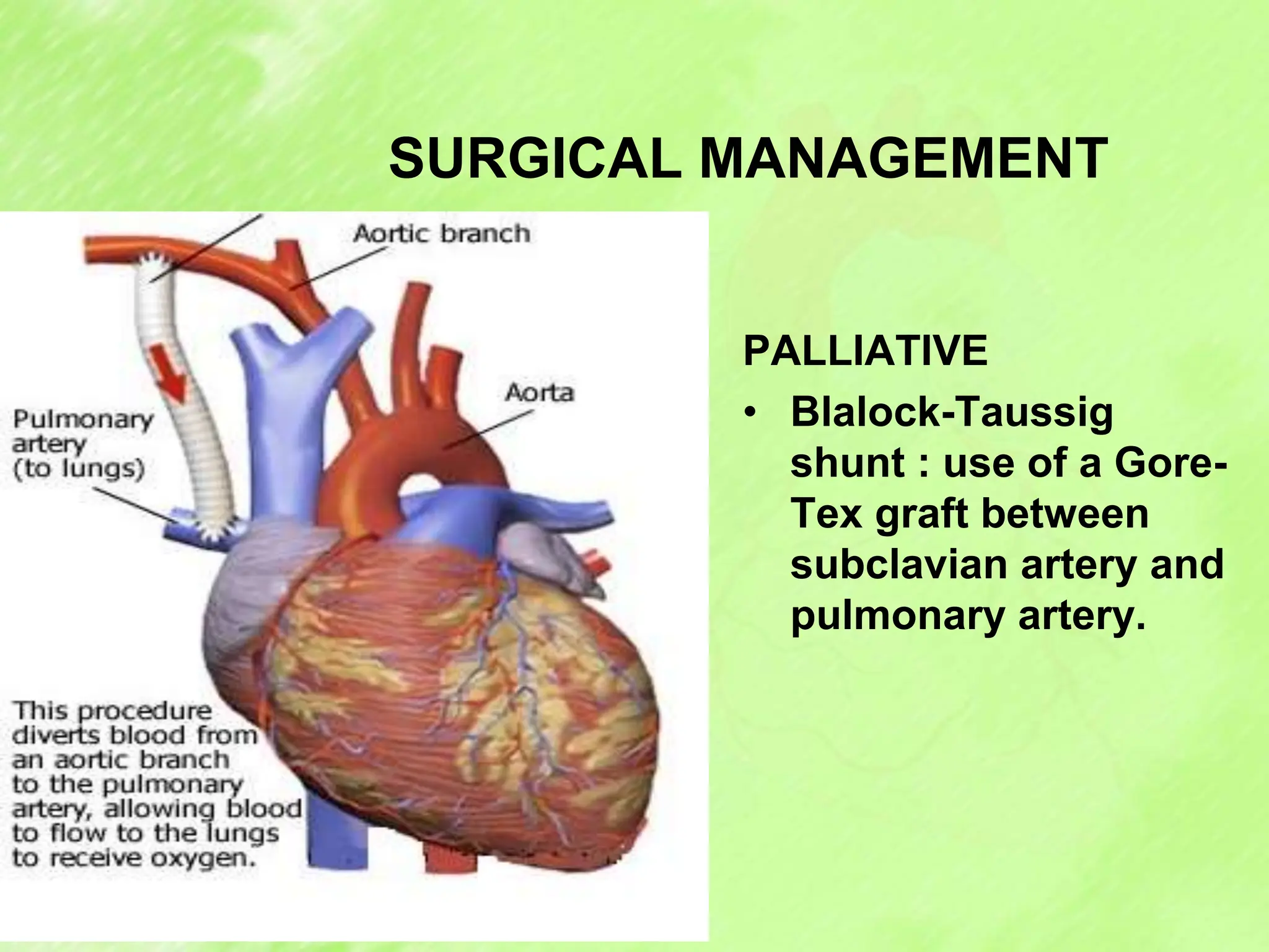 SURGICAL MANAGEMENT
PALLIATIVE
• Blalock-Taussig
shunt : use of a Gore-
Tex graft between
subclavian artery and
pulmonary artery.
 