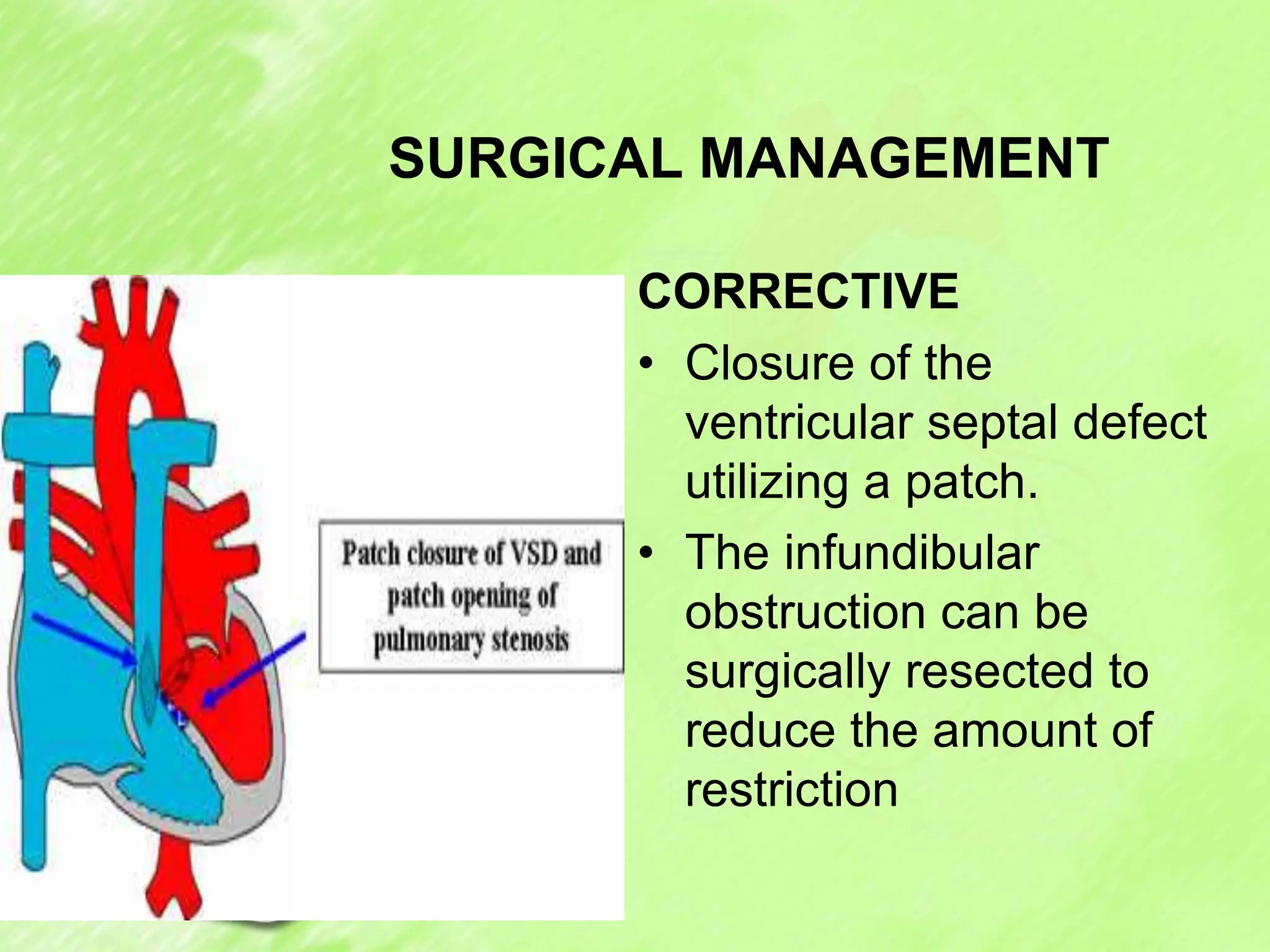 SURGICAL MANAGEMENT
CORRECTIVE
• Closure of the
ventricular septal defect
utilizing a patch.
• The infundibular
obstruction can be
surgically resected to
reduce the amount of
restriction
 