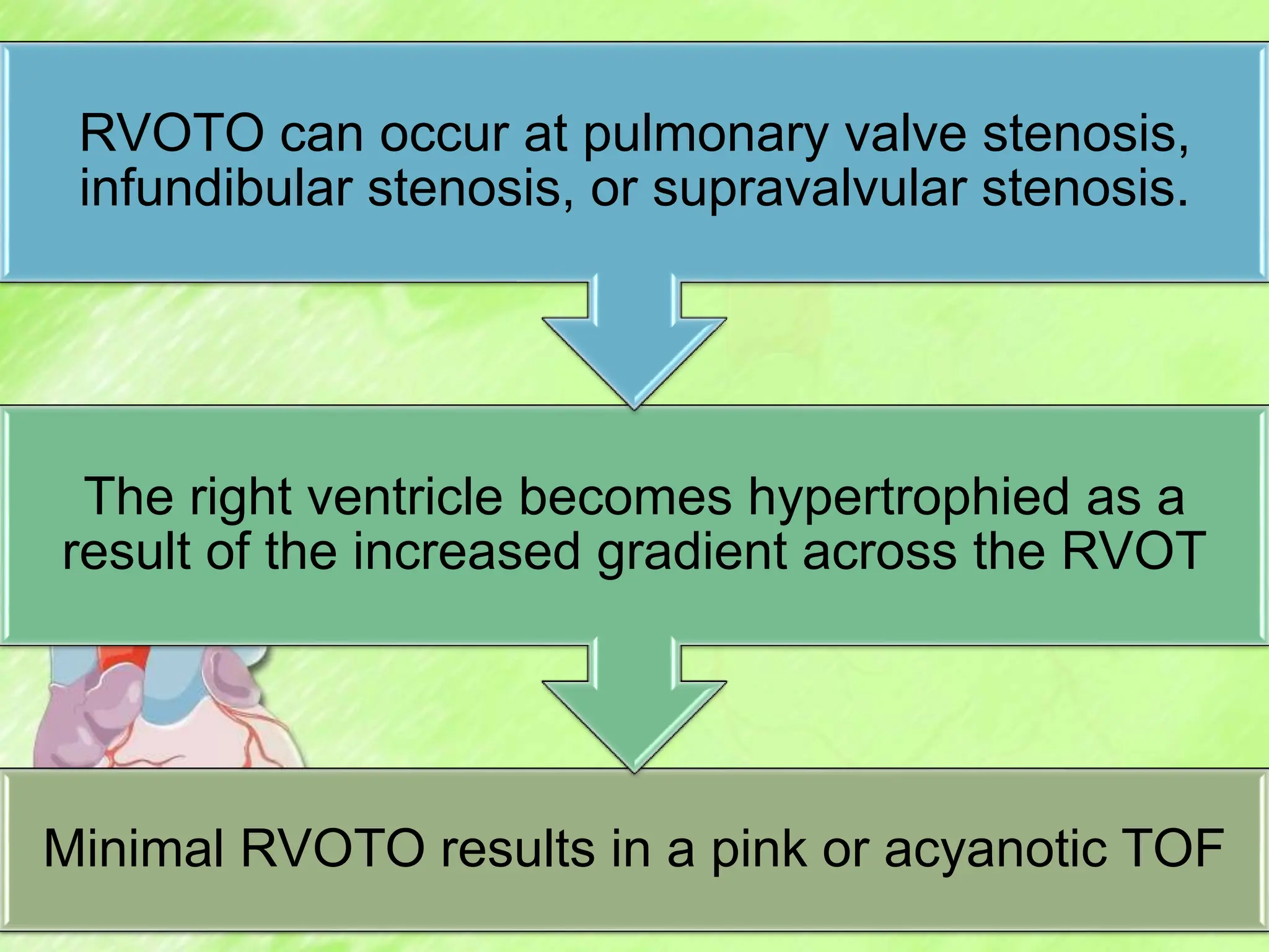 Minimal RVOTO results in a pink or acyanotic TOF
The right ventricle becomes hypertrophied as a
result of the increased gradient across the RVOT
RVOTO can occur at pulmonary valve stenosis,
infundibular stenosis, or supravalvular stenosis.
 