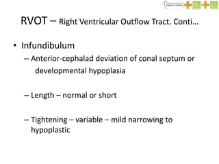 Tof ppt | PPTX