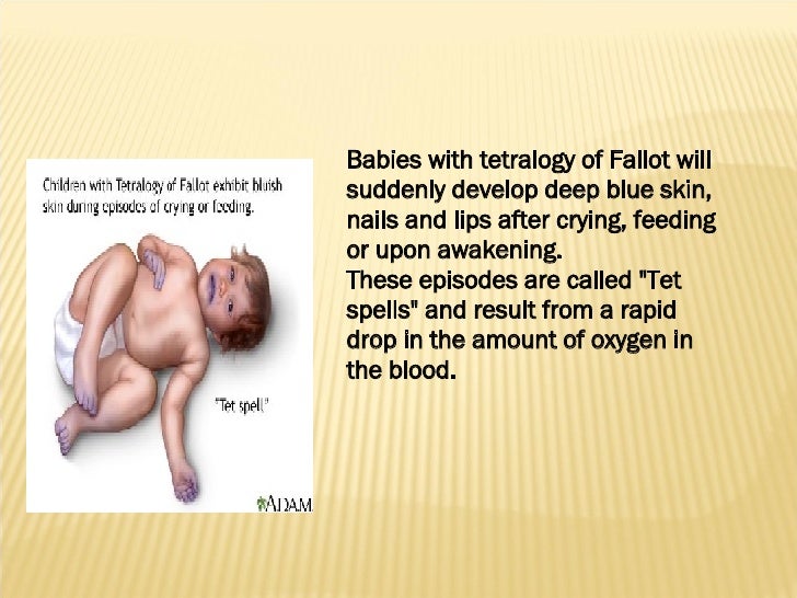 TETRALOGY OF FALLOT, PARENT TEACHING