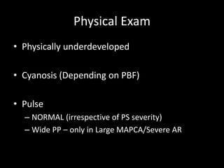 Physical Exam
• Physically underdeveloped
• Cyanosis (Depending on PBF)
• Pulse
– NORMAL (irrespective of PS severity)
– Wide PP – only in Large MAPCA/Severe AR
 