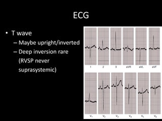 ECG
• T wave
– Maybe upright/inverted
– Deep inversion rare
(RVSP never
suprasystemic)
 