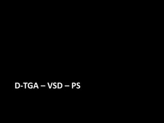 D-TGA – VSD – PS
 