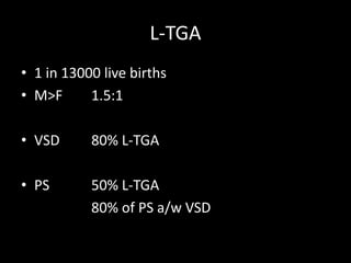 L-TGA
• 1 in 13000 live births
• M>F 1.5:1
• VSD 80% L-TGA
• PS 50% L-TGA
80% of PS a/w VSD
 