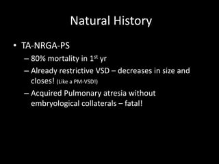 Natural History
• TA-NRGA-PS
– 80% mortality in 1st yr
– Already restrictive VSD – decreases in size and
closes! (Like a PM-VSD!)
– Acquired Pulmonary atresia without
embryological collaterals – fatal!
 
