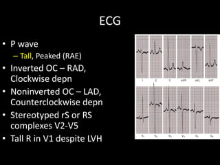 ECG
• P wave
– Tall, Peaked (RAE)
• Inverted OC – RAD,
Clockwise depn
• Noninverted OC – LAD,
Counterclockwise depn
• Stereotyped rS or RS
complexes V2-V5
• Tall R in V1 despite LVH
 