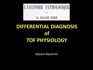 DIFFERENTIAL DIAGNOSIS
of
TOF PHYSIOLOGY
Satyam Rajvanshi
 