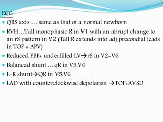 Tetrology of Fallot | PPTX