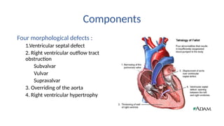 TOF_echocardiographic asssessment-seminar | PPTX