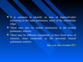  It is common to identify an area of supravalvularr
narrowing in the main pulmonary artery at the sinotubular
ridge.
 There may also be further obstruction at the branch
pulmonary arteries.
 These may be diffusely hypoplastic or have focal areas of
stenosis, most commonly at the proximal branch
pulmonary arteries.
Rao et al .Am J Cardiol 1971
 