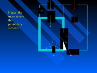 Hence, the
more severe
the
pulmonary
stenosis
 