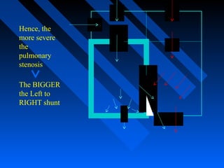 Hence, the
more severe
the
pulmonary
stenosis
The BIGGER
the Left to
RIGHT shunt
 