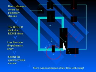 Hence, the more
severe the
pulmonary
stenosis
The BIGGER
the Left to
RIGHT shunt
Less flow into
the pulmonary
artery
Shorter the
ejection systolic
murmur
More cyanosis because of less flow to the lung!
 
