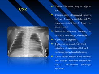 CXR
 Normal sized heart; [may be large in
PA]
 Upturned apex; attenuated & concave
left heart border (infundibular and PA
hypoplasia)….boot-shaped heart, or
coeur en sabot
 Diminished pulmonary vascularity in
proportion to the degree of cyanosis.
 Right atrial enlargement
 Right-sided aortic arch (20-25% of
patients) with indentation of leftward-
positioned tracheobronchial shadow.
 Absent thymic shadow in the newborn
may indicate associated chromosome
22q11.2 microdeletion (DiGeorge
syndrome).
 