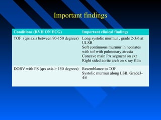 Important findings
Conditions (RVH ON ECG) Important clinical findings
TOF (qrs axis between 90-150 degrees) Long systolic murmur , grade 2-3/6 at
ULSB
Soft continuous murmur in neonates
with tof with pulmonary atresia
Concave main PA segment on cxr
Right sided aortic arch on x ray film
DORV with PS (qrs axis > 150 degrees) Resemblance to TOF
Systolic murmur along LSB, Grade3-
4/6
 
