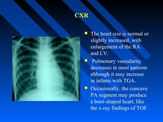 CXR
 The heart size is normal or
slightly increased, with
enlargement of the RA
and LV.
 Pulmonary vascularity
decreases in most patients
although it may increase
in infants with TGA.
 Occasionally, the concave
PA segment may produce
a boot-shaped heart, like
the x-ray findings of TOF.
 