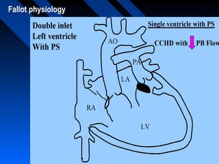Fallot physiology
 