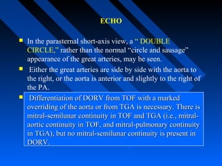 ECHO
 In the parasternal short-axis view, a “ DOUBLE
CIRCLE,” rather than the normal “circle and sausage”
appearance of the great arteries, may be seen.
 Either the great arteries are side by side with the aorta to
the right, or the aorta is anterior and slightly to the right of
the PA.
 Differentiation of DORV from TOF with a markedDifferentiation of DORV from TOF with a marked
overriding of the aorta or from TGA is necessary. There isoverriding of the aorta or from TGA is necessary. There is
mitral-semilunar continuity in TOF and TGA (i.e., mitral-mitral-semilunar continuity in TOF and TGA (i.e., mitral-
aortic continuity in TOF, and mitral-pulmonary continuityaortic continuity in TOF, and mitral-pulmonary continuity
in TGA), but no mitral-semilunar continuity is present inin TGA), but no mitral-semilunar continuity is present in
DORV.DORV.
 