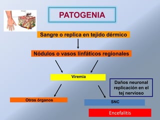PATOGENIA

      Sangre o replica en tejido dérmico


   Nódulos o vasos linfáticos regionales



                  Viremia
                                  Daños neuronal
                                  replicación en el
                                    tej nervioso
Otros órganos                    SNC

                                Encefalitis
 